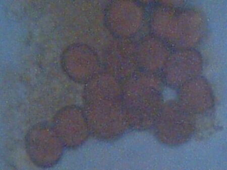 blood cells
