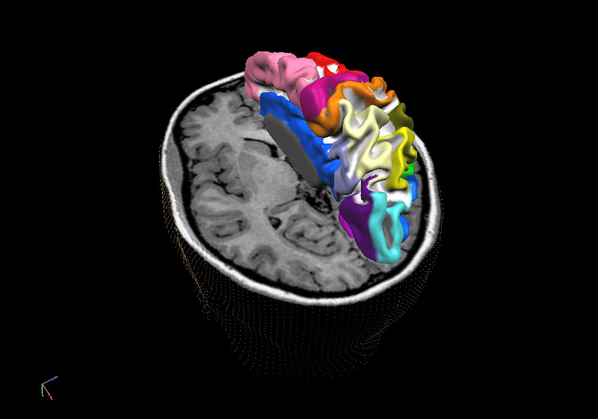Pineal Gland