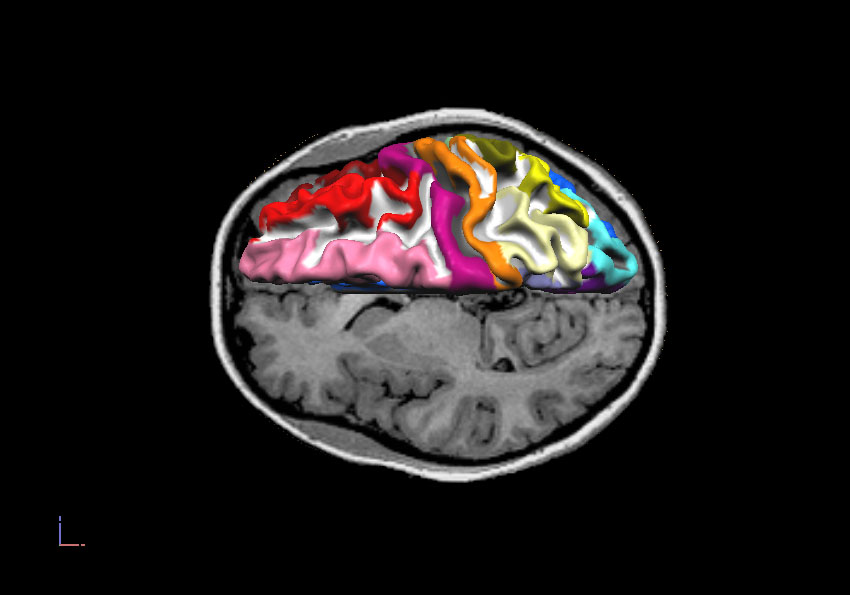 Pineal Gland